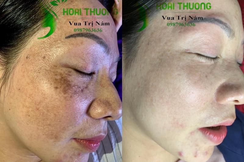 Hoài Thương Spa