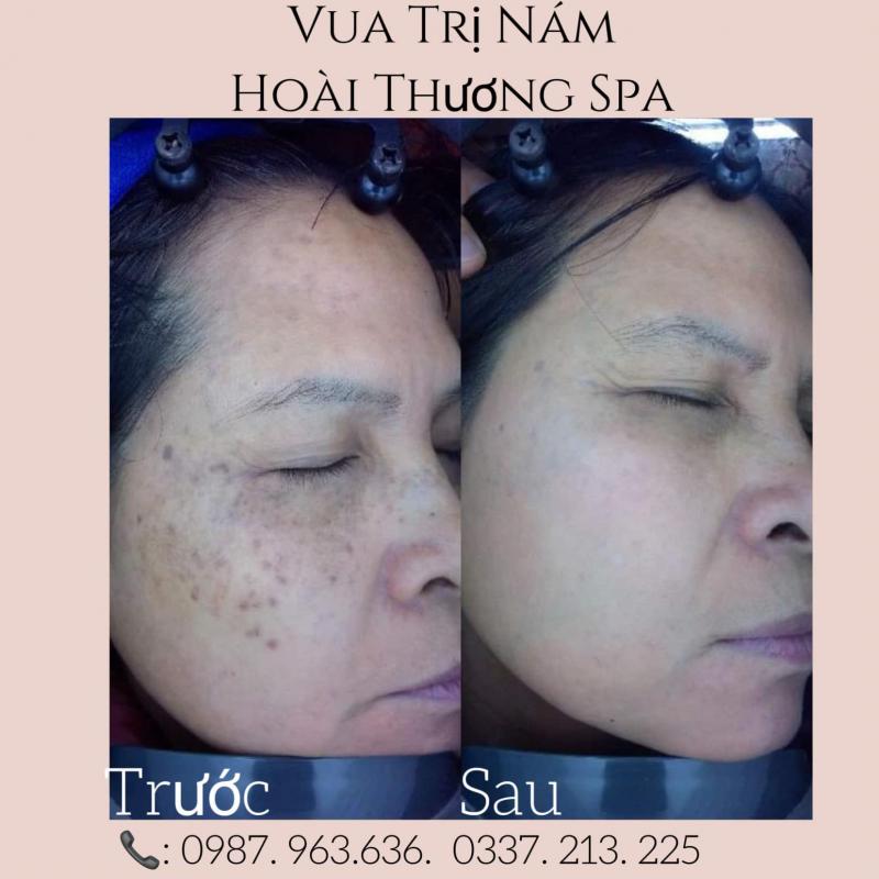 Hoài Thương Spa