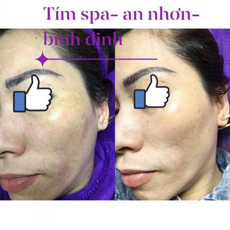 Tím Spa