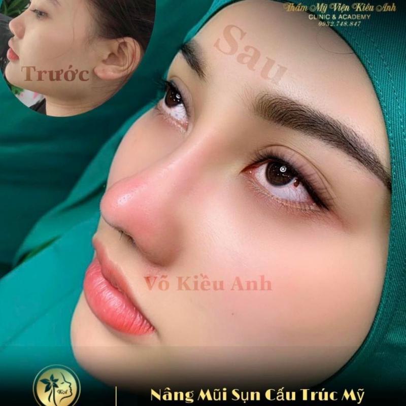 Kiều Anh Beauty