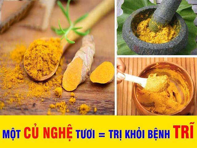 Kinh nghiệm chữa bệnh trĩ từ củ nghệ