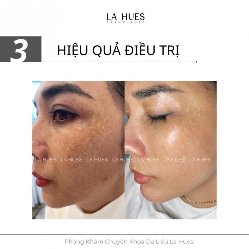 La Hues Spa & Clinic