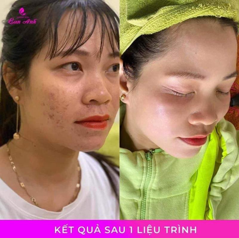 Lan Anh House Spa