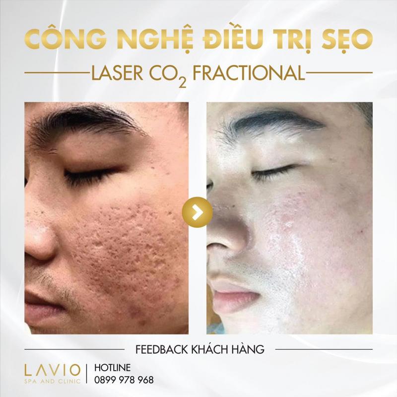 LAVIO Spa & Clinic Cần Thơ