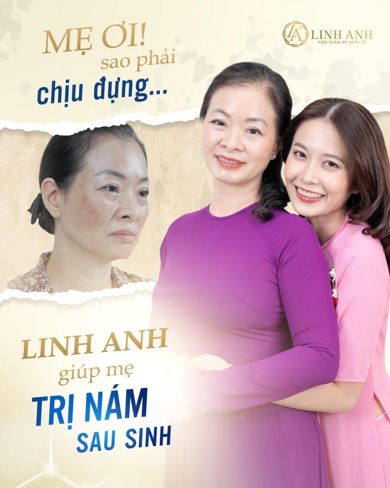 Linh Anh – Viện Thẩm Mỹ Quốc Tế