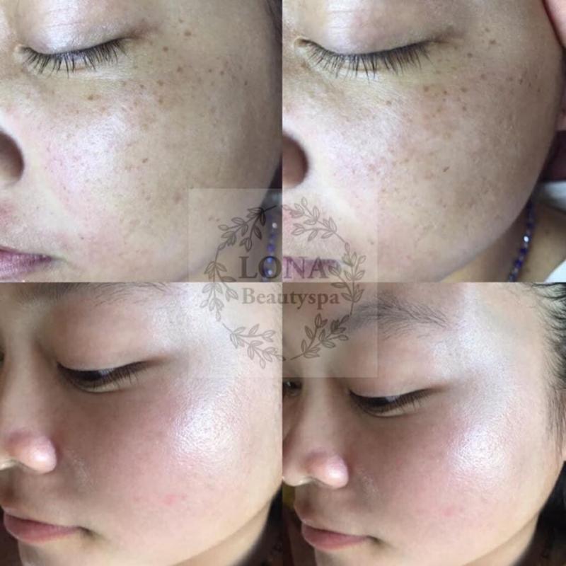 Lona Beauty Spa