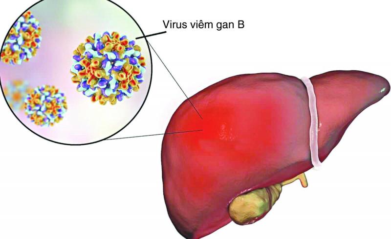 Không dùng cho bệnh nhân bệnh gan, suy hô hấp