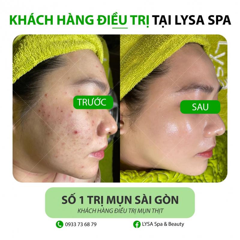 LYSA Spa & Beauty