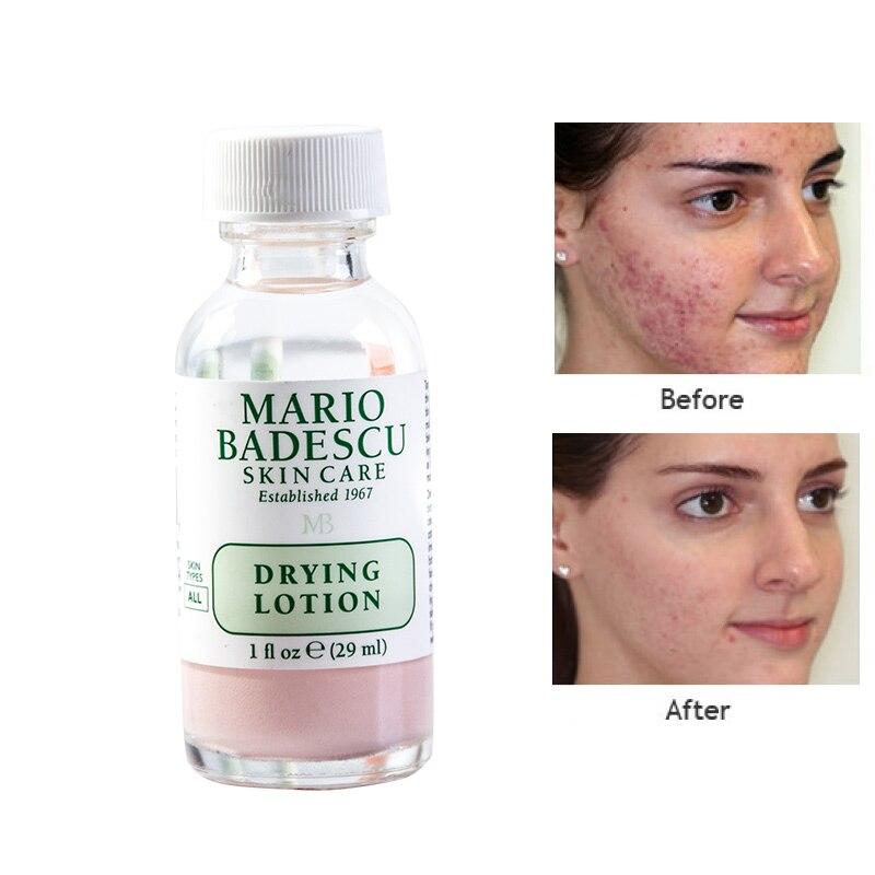 Mario Badescu Drying Lotion