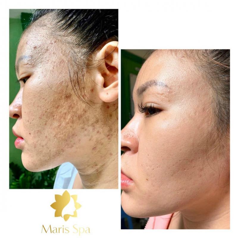 Maris Spa