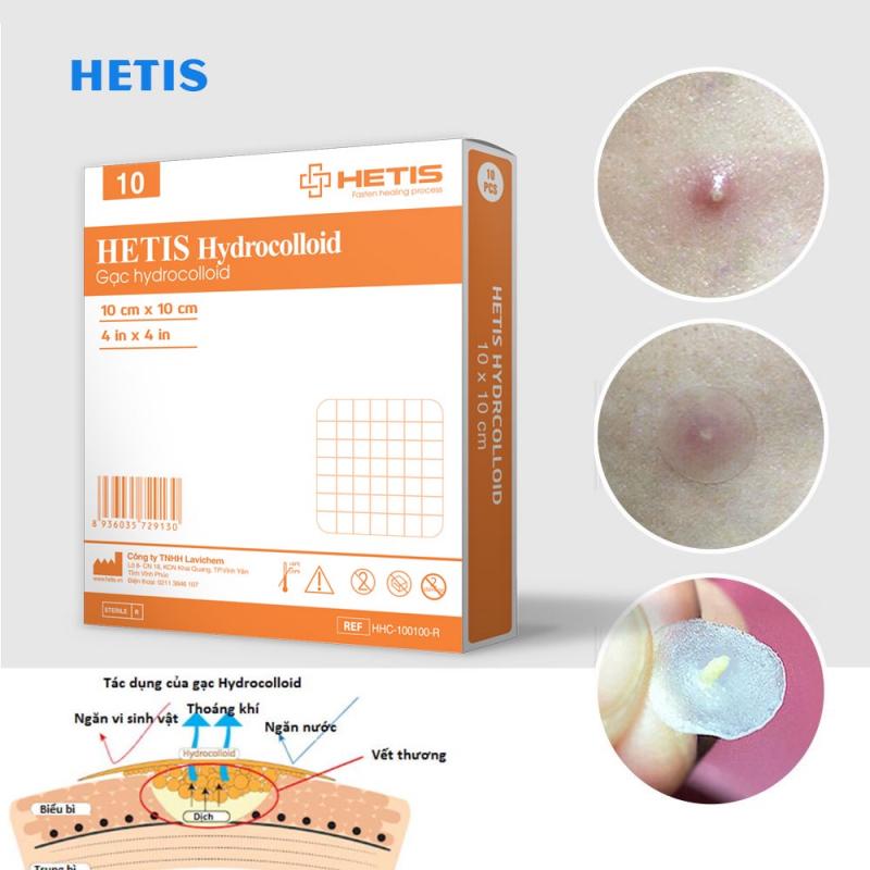 Miếng dán mụn, vết thương Hetis Hydrocolloid giúp thấm hút dịch, loại bỏ những mô chết, ngăn ngừa sẹo