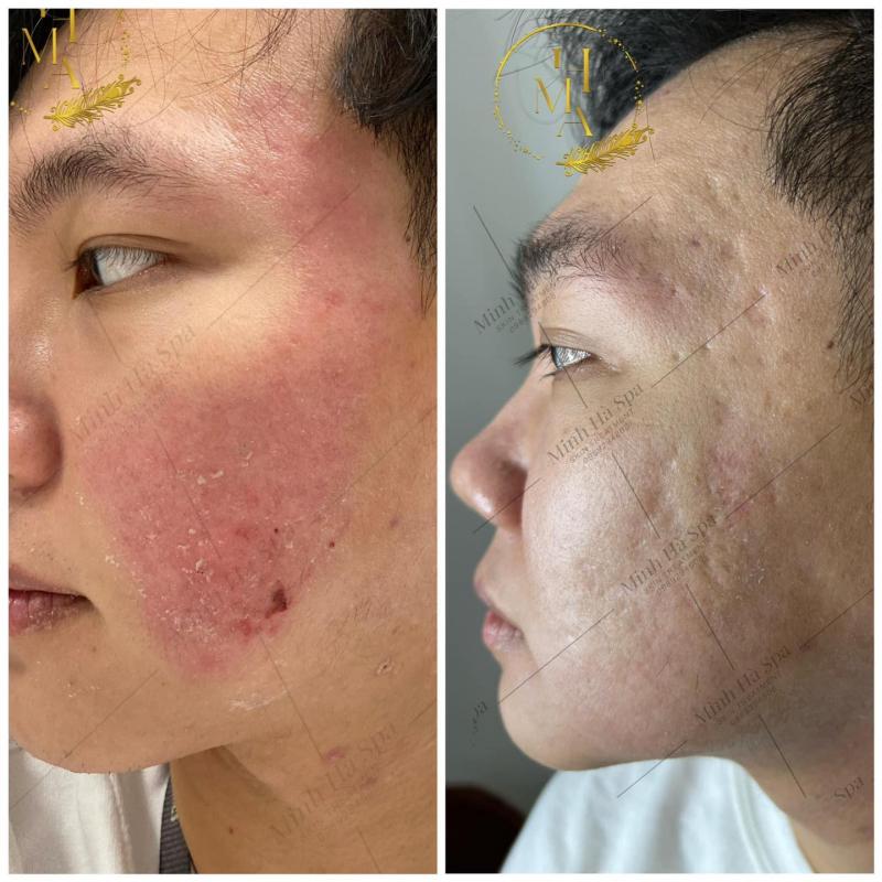 Minh Ha Spa