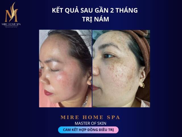 MiRe Home Spa