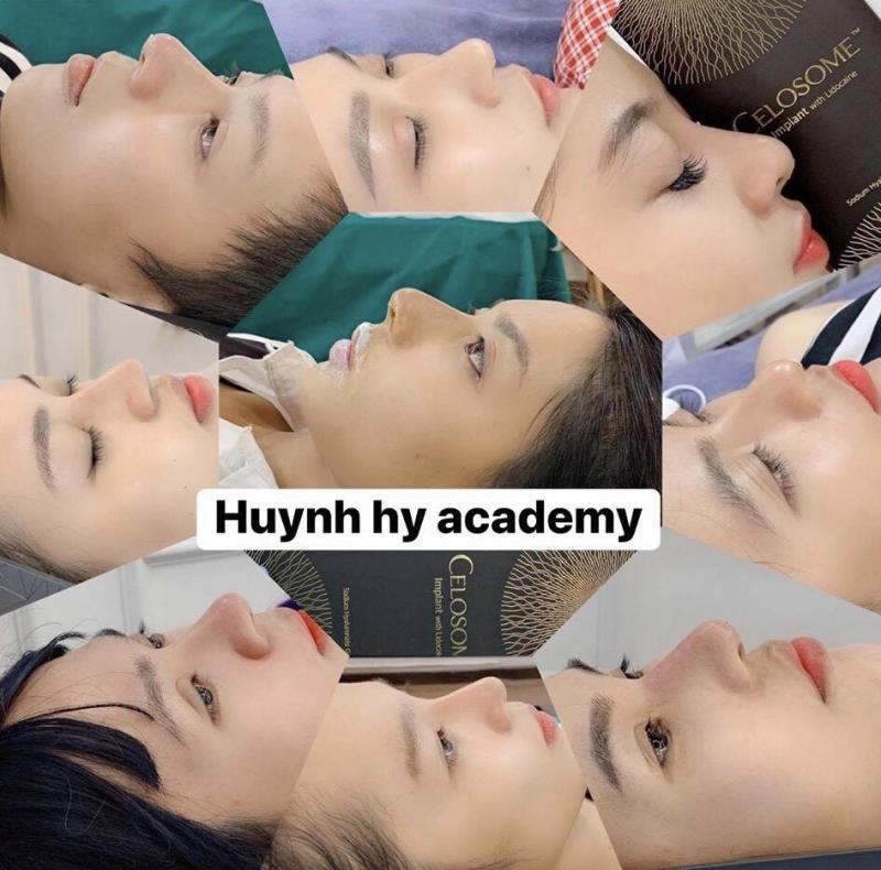 Mộc Beauty Spa (Huynh Hy Academy - Tiêm Filler Nhấn Mí hàng đầu Phú Quốc)