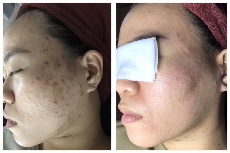 Mộc Spa Tam Kỳ