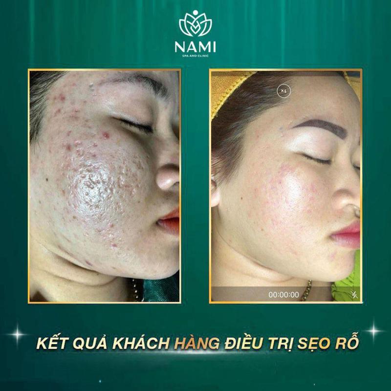 Nami Spa Beauty & Clinic