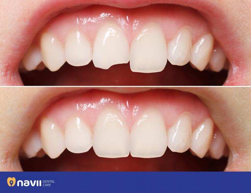 Navii Dental Care