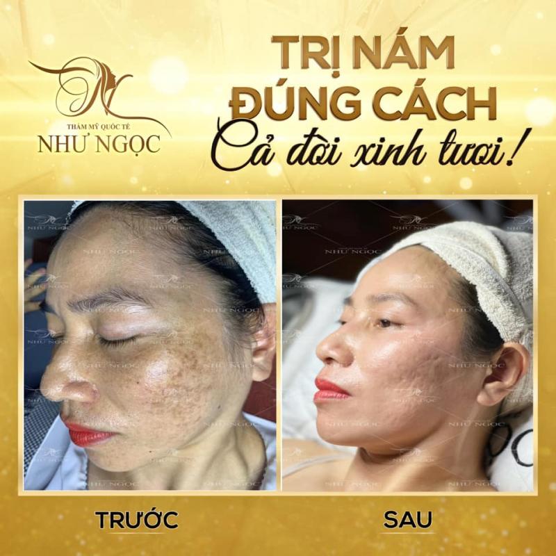 Ngọc Beauty Spa
