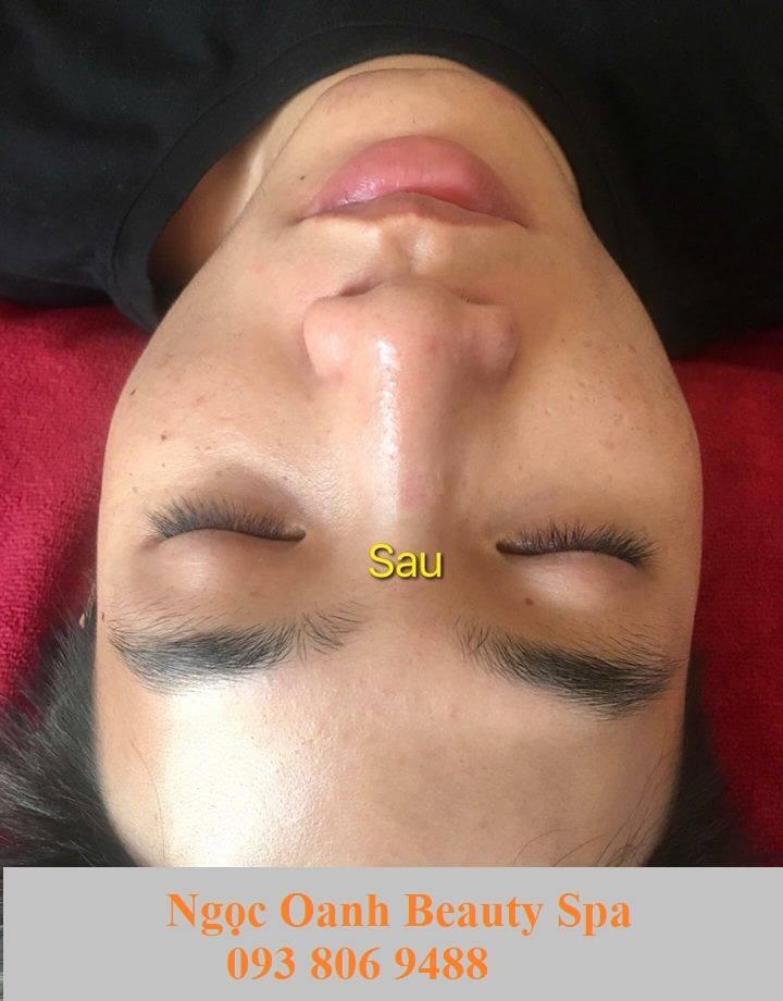 Ngọc Oanh Beauty Spa