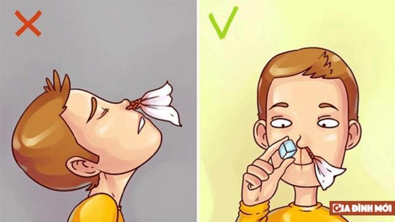 Nguyên nhân bị chảy máu cam