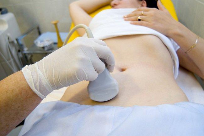 Siêu âm u xơ tử cung định kì