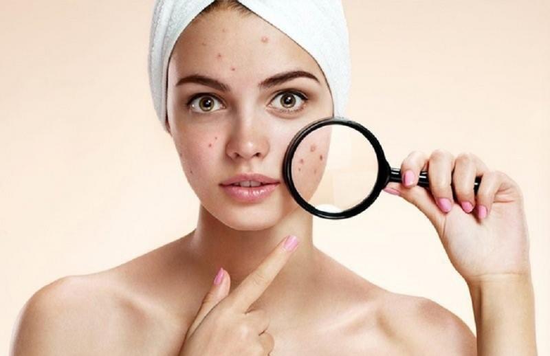 Nguyên nhân gây dị ứng mỹ phẩm