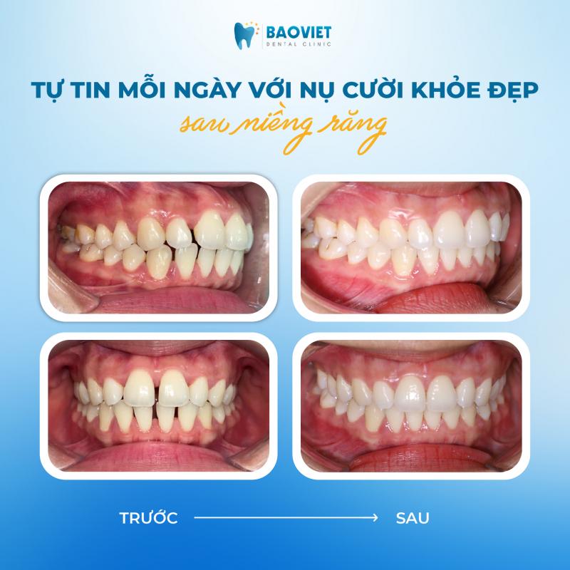Nha khoa Bảo Việt