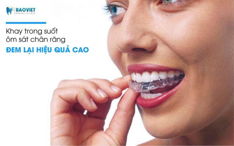 Nha khoa Bảo Việt