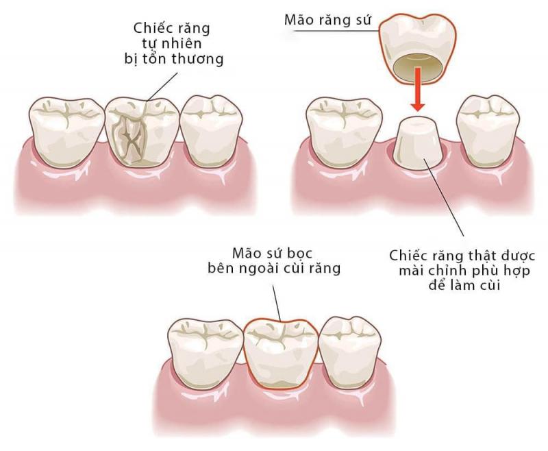 Nha khoa Diệu Thiện