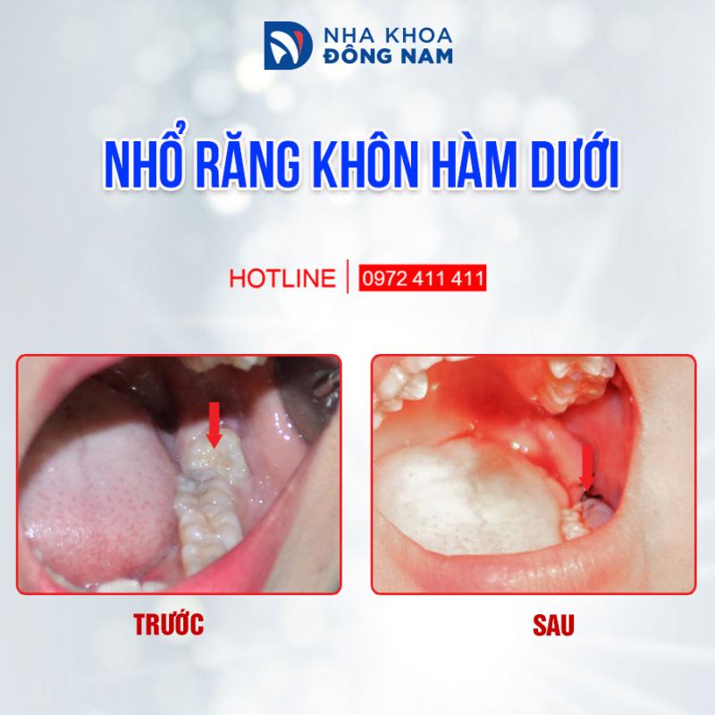 Nha khoa Đông Nam
