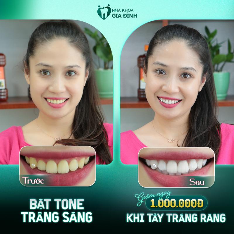 Nha khoa Gia Đình