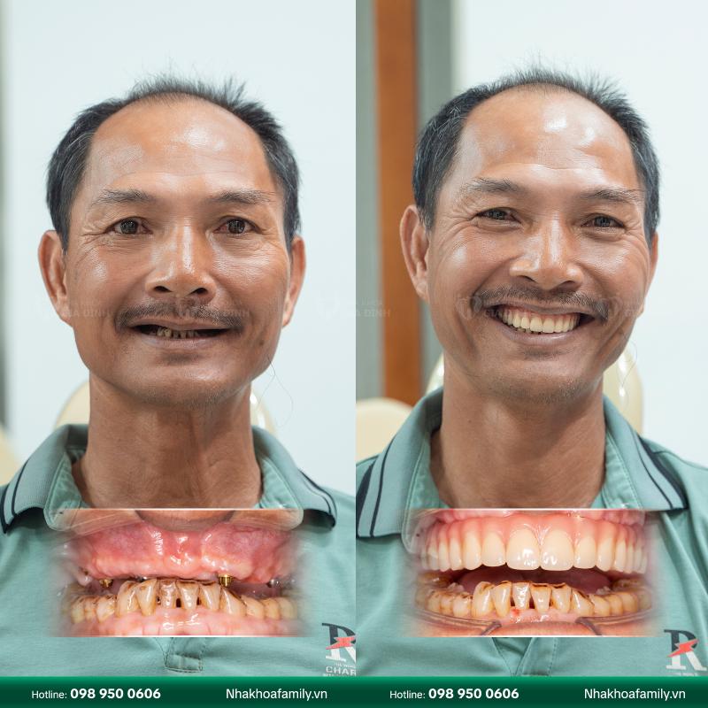 Nha Khoa Gia Đình