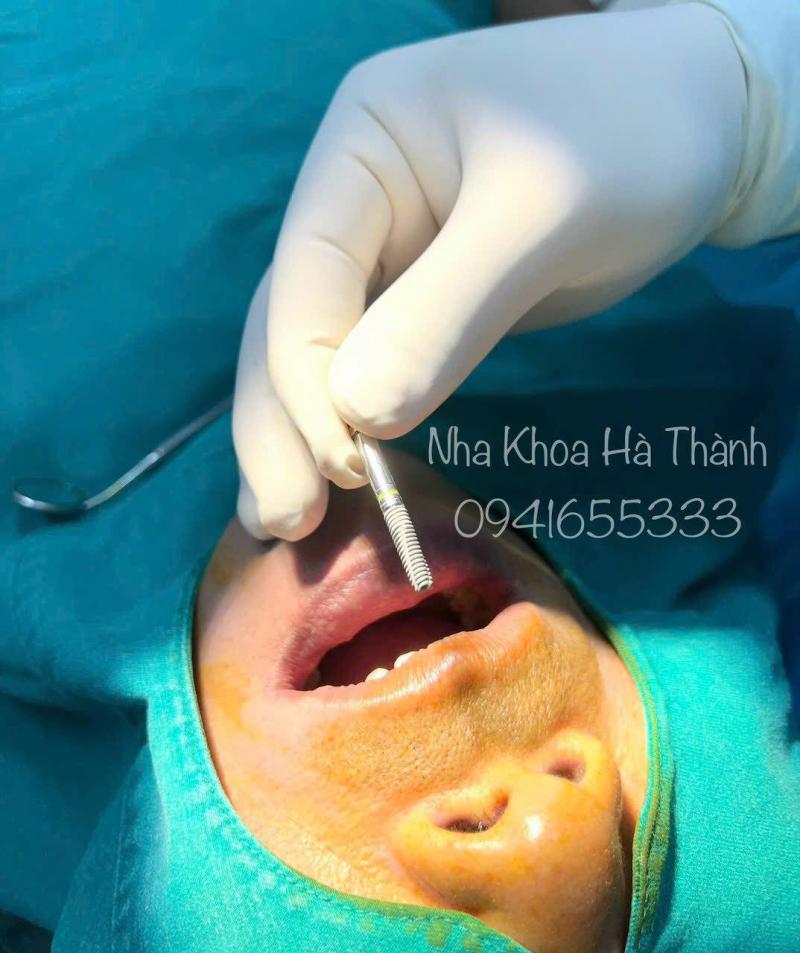 Nha Khoa Hà Thành
