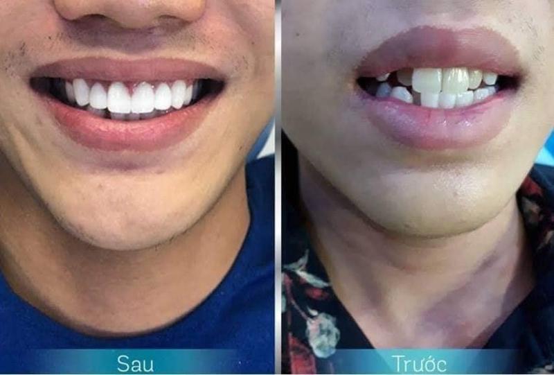 Nha Khoa HT Dental