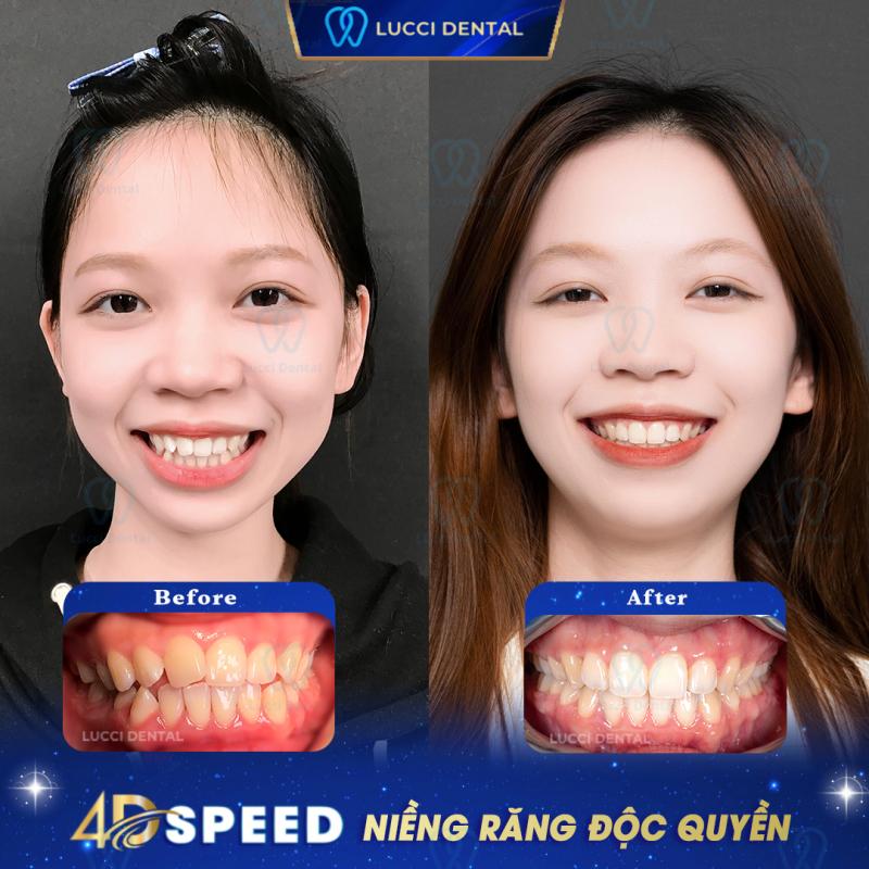 Nha khoa Lucci
