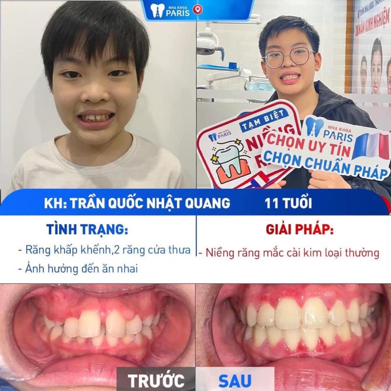 Nha khoa Paris
