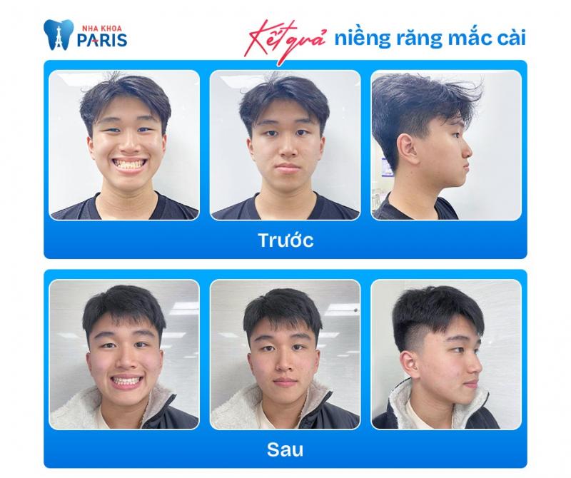 Nha khoa Paris