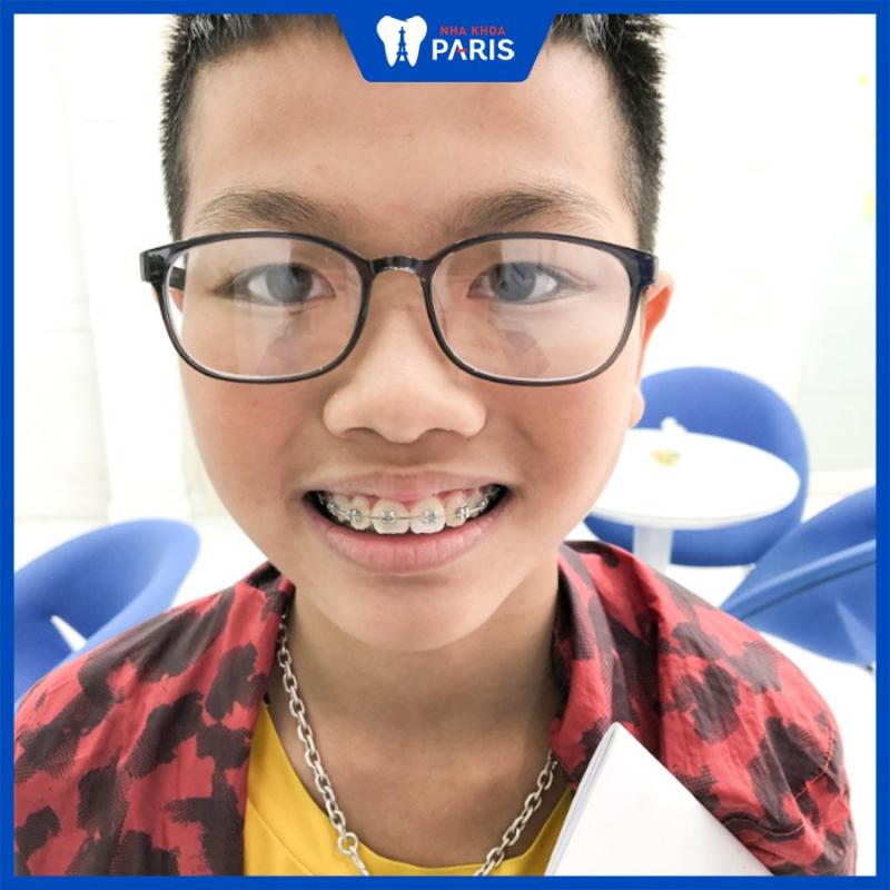 Nha khoa Paris Vinh