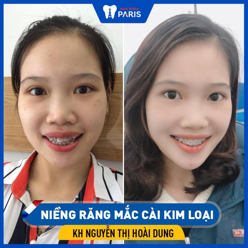 Nha khoa Paris Vinh
