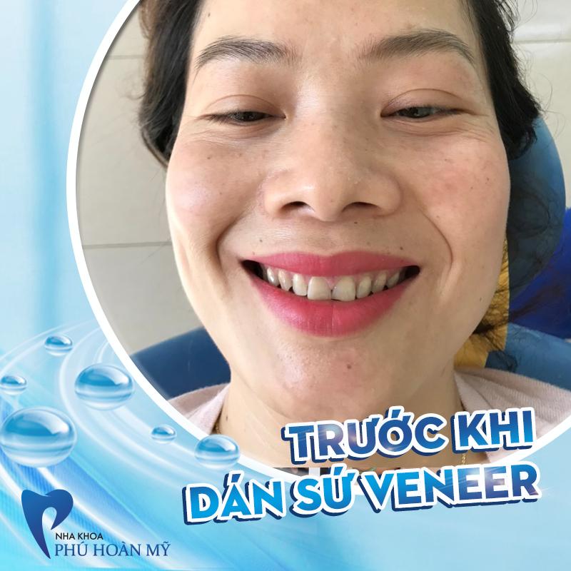 Nha Khoa Phú Hoàn Mỹ