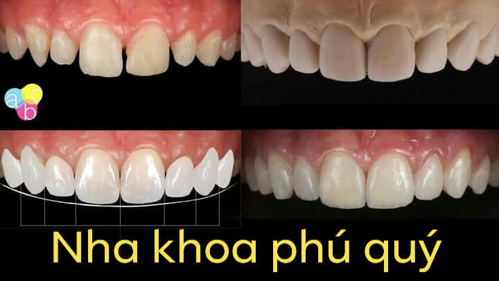 Nha khoa Phú Quý