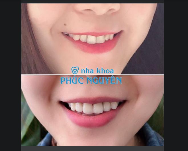 Nha khoa Phúc Nguyên