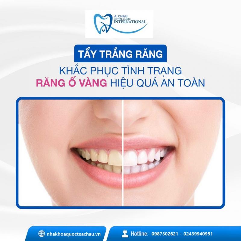 Nha khoa Quốc tế Á Châu