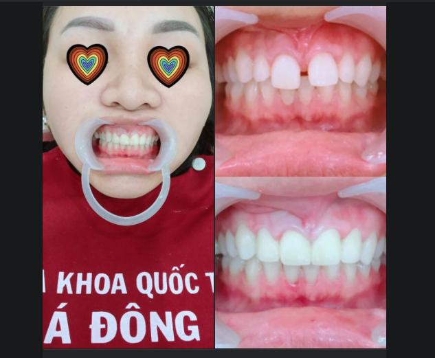 Nha Khoa Quốc Tế Á Đông