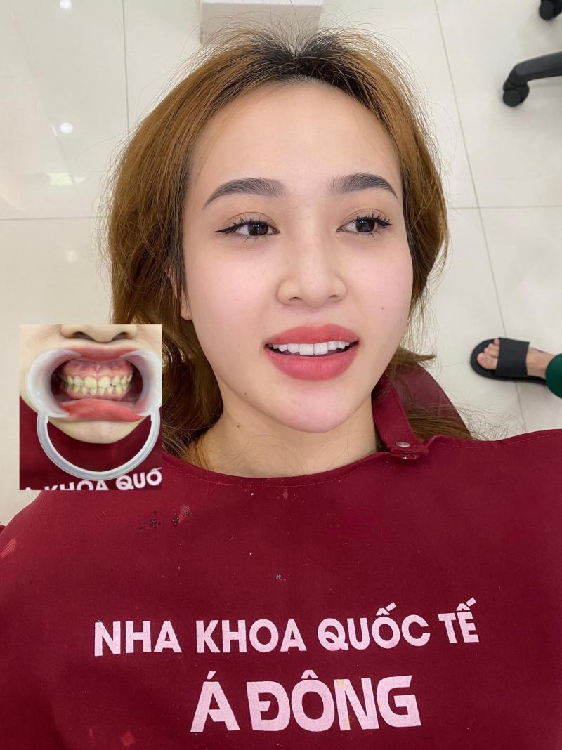 Nha Khoa Quốc Tế Á Đông - BMT