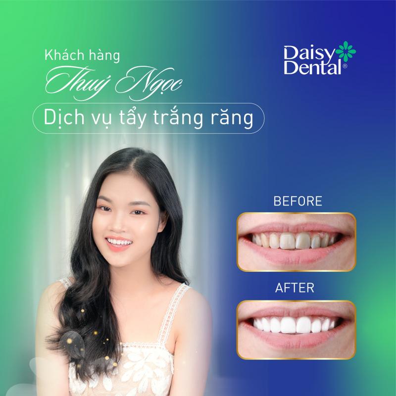 Nha Khoa Quốc tế DAISY