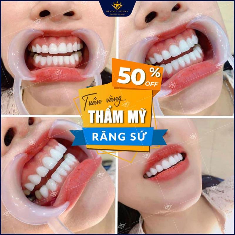 Nha Khoa Dencos Luxury