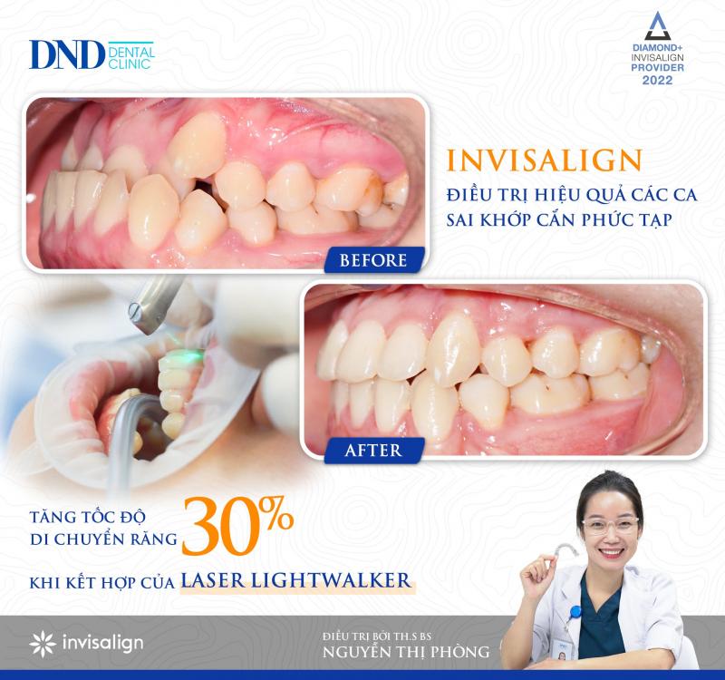 Nha khoa Quốc tế DND