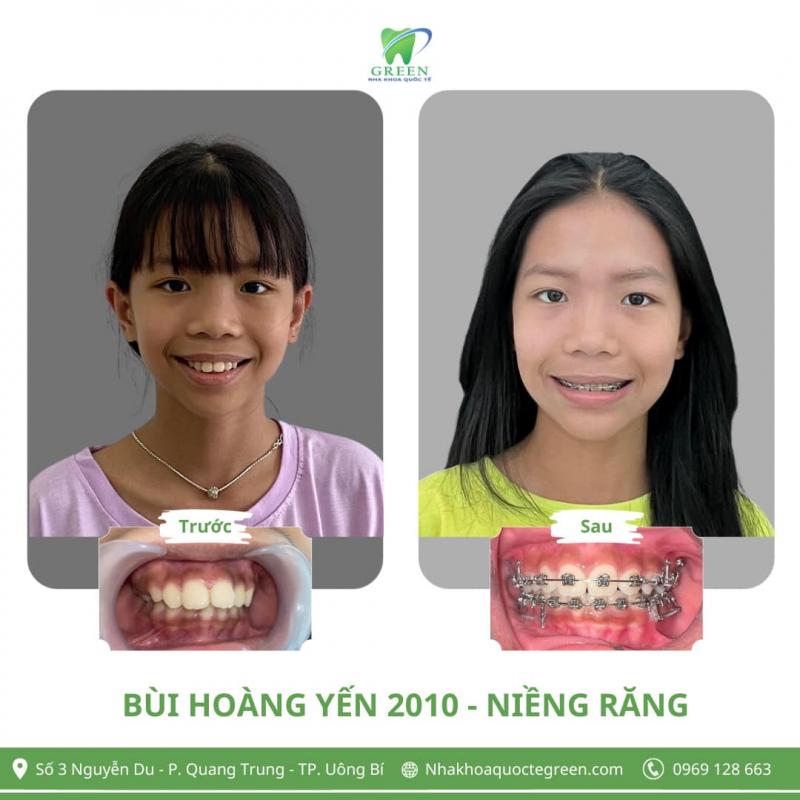 Nha Khoa Quốc Tế GREEN
