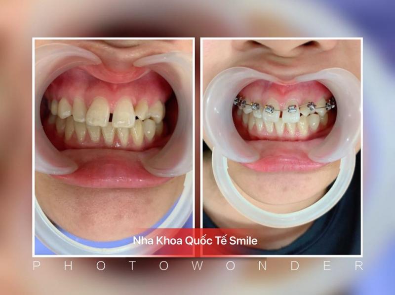 Nha khoa quốc tế Smile